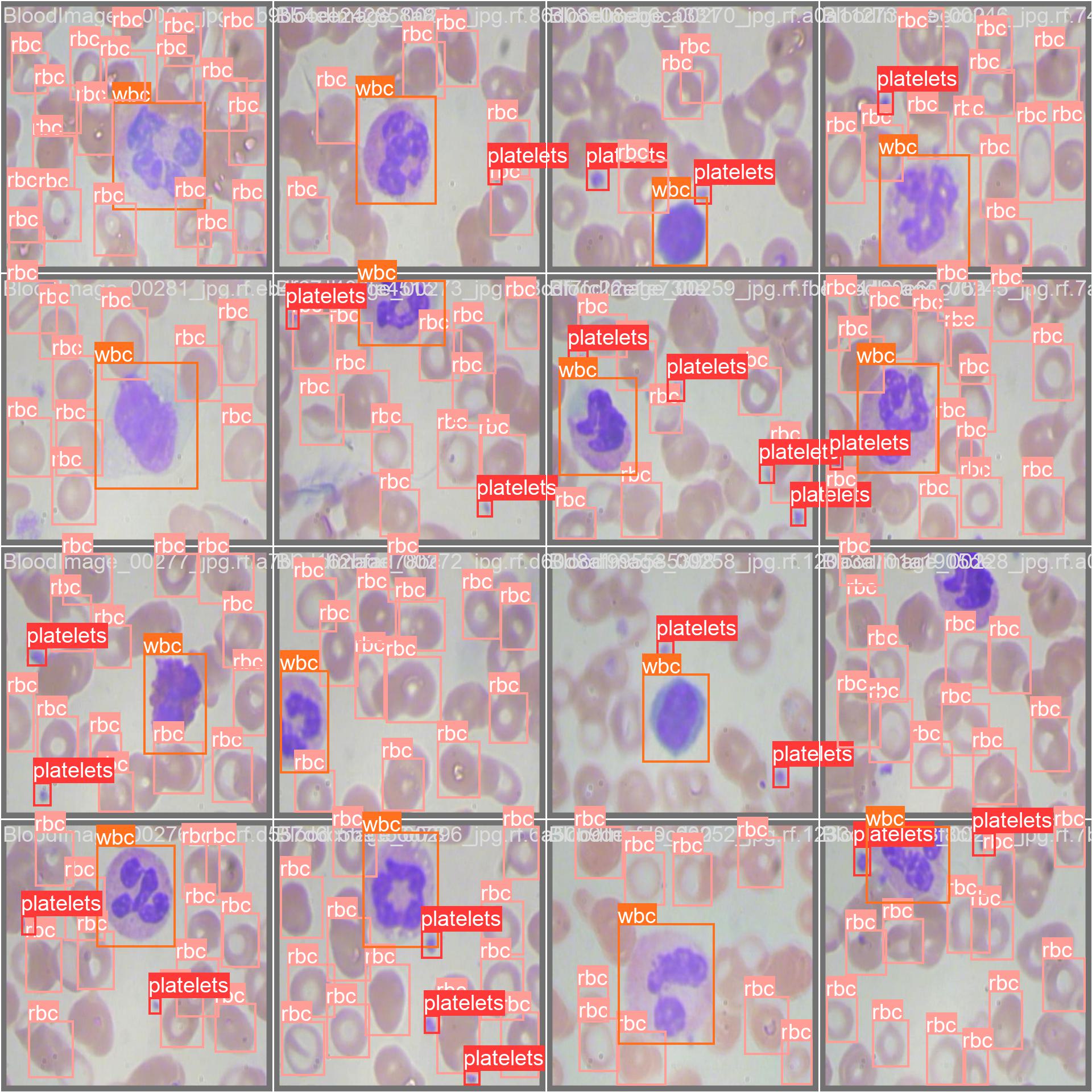 keremberke/yolov5n-blood-cell